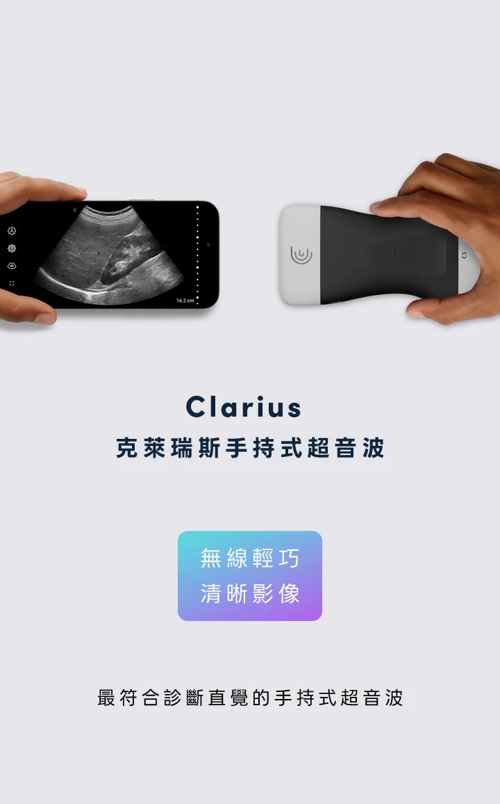 Clarius 克萊瑞斯手持式超音波：無線輕巧、清晰影像，最符合診斷直覺的手持式超音波